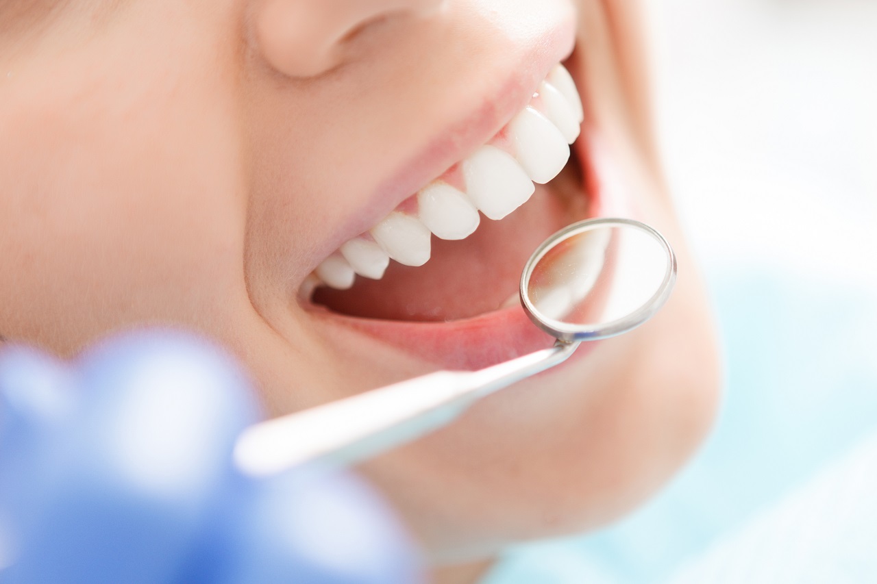 Dlaczego warto się zdecydować na założenie licówek zębowych?